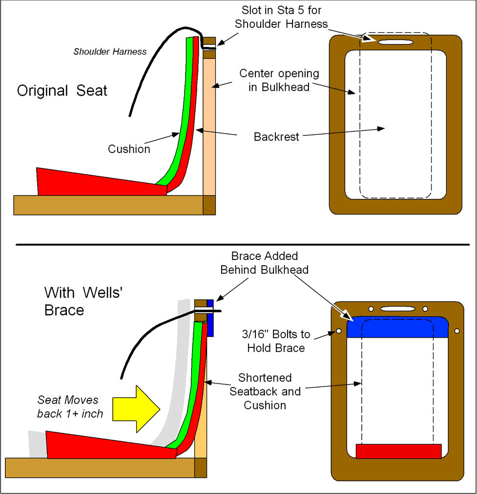 brace diagram